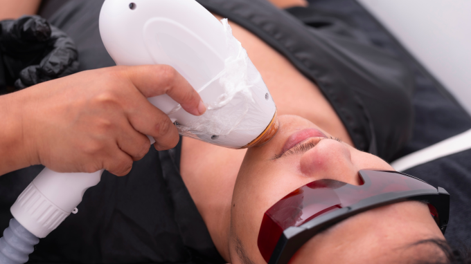 procedimiento-estetico-shutterstock_2476013277