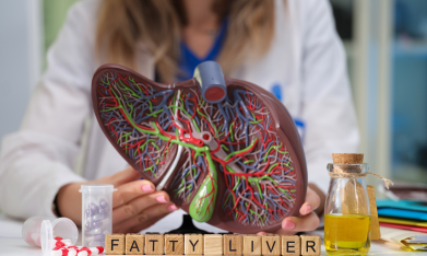 higado-graso