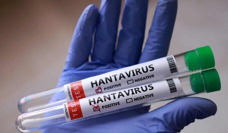 canada-reporta-casos-de-hantavirus-en-pasajeros-del-mv-hondius-ec41f9a1-focus-0-0-453-264